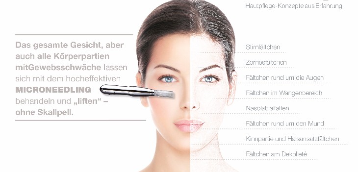 microneedling